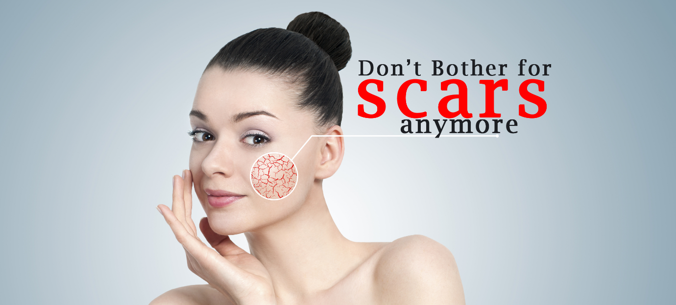 How To Get Rid Of Acne Scars With Anti-Scars Face Cream?